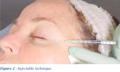 injectable technique bio restructuring