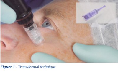 transdermal technique bio restructuring
