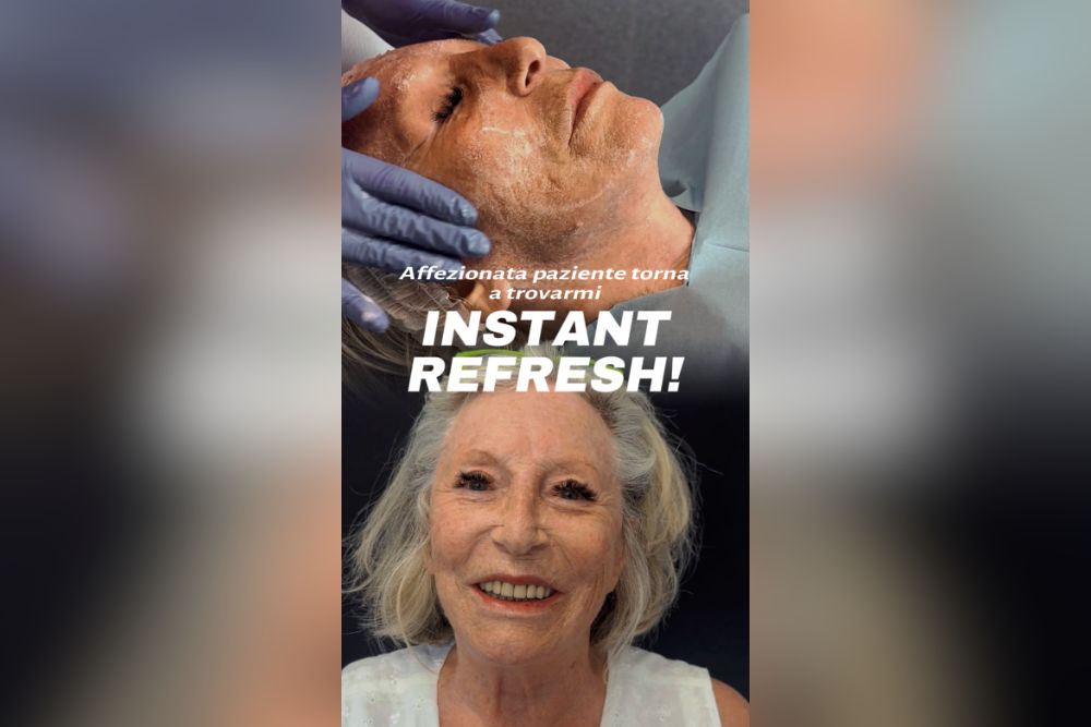 mantenimento dopo il lifting del viso